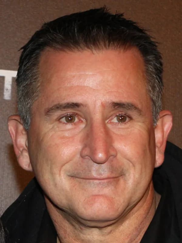 Anthony LaPaglia