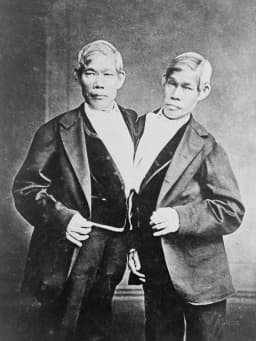 Chang and Eng Bunker