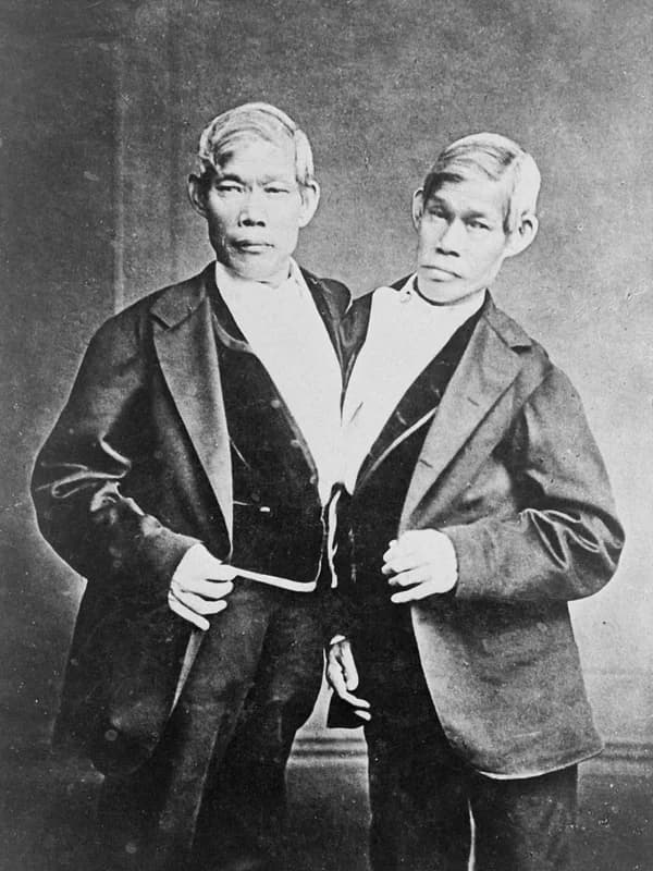 Chang and Eng Bunker